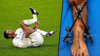 Thumbnail: Crazy Football Injuries #34 | Football “SCARIEST” Moments