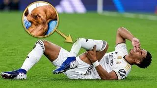 Thumbnail: Crazy Football Injuries #33 | Football “SCARIEST” Moments