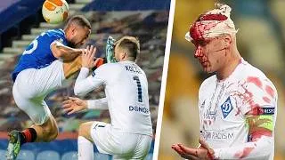 Thumbnail: Crazy Football Injuries #32 | Football “SCARIEST” Moments
