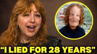 Thumbnail: Before She Died, Rocky Dennis's Mom FINALLY Broke Silence About Rocky Dennis And It's BAD