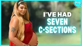 Thumbnail: I've Had 7 C-Sections - Now I'm A Mom-Of-11 | MY EXTRAORDINARY FAMILY