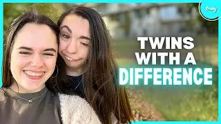 Thumbnail: My Twin Was Born Without An Ear & Jawbone | BORN DIFFERENT