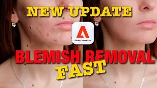 Thumbnail: New ACR Update: Blemish Removal Adobe Camera Raw
