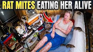 Thumbnail: Rat Mites Were Eating This Elderly Woman Alive In Her Mobile Home