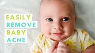 Thumbnail: Newborn baby Lightroom Edit: how to QUICKLY remove baby acne