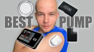 Thumbnail: I Tried Every Insulin Pump. This One Is Best in 2026!