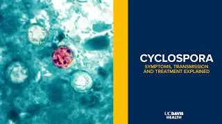 Thumbnail: Cyclospora Parasite Outbreak: Symptoms, Treatment and How It Spreads | UC Davis Health