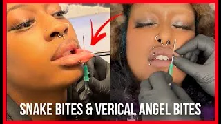 Thumbnail: FULL PROCESS HERE! ⚠️ Snake Bites & Vertical Angel Bites: Which one would you get?