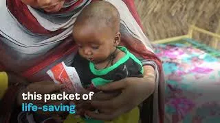 Thumbnail: You can help deliver a Packet of Hope to malnourished children.