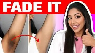 Thumbnail: How To Treat Under Arm Pigmentation 