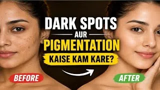 Thumbnail: Pigmentation Se Kaise Chhutkara Paaye? Best Routine for Beginners