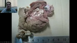 Thumbnail: Muscular coenurosis in a rabbit #coenurosis #coenurus #taenia #rabbit