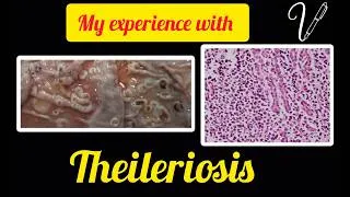 Thumbnail: Theileriosis #Theileriosis #cow