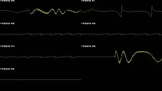 Thumbnail: Mr. Nutz (GEN/MD) - Clouds - In Oscilloscope View!