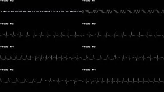 Thumbnail: Quartet (Arcade) - Quartet Theme - In Oscilloscope View!