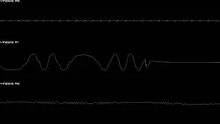 Thumbnail: Road Rash (GEN/MD) - Pacific Coast - In Oscilloscope View!