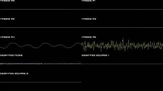 Thumbnail: Pulseman (GEN/MD) - Metamorphoser - In Oscilloscope View!
