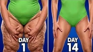 Thumbnail: Inner Thigh And Thigh Fat Exercise at Home 🔥