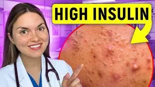 Thumbnail: What Your FACE Says About Your HEALTH: Doctor Explains