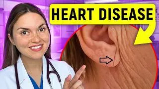 Thumbnail: 13 Signs of HEART DISEASE You Can See: Doctor Explains