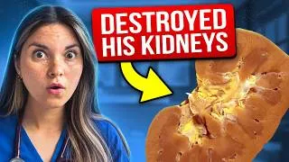 Thumbnail: Healthy Snack DESTROYED His KIDNEYS: Medical Mystery Solved