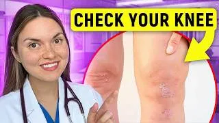 Thumbnail: What Your KNEES Say About Your HEALTH: Arthritis Doctor Explains