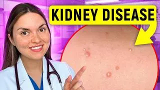 Thumbnail: 17 Signs of KIDNEY DISEASE You Can See: Doctor Explains