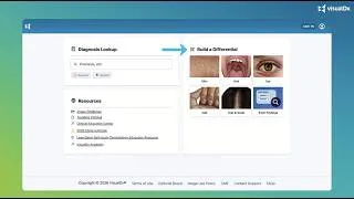 Thumbnail: The New VisualDx: Build Better Differentials—Faster