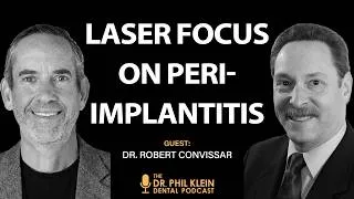 Thumbnail: Making the Laser Leap: Implant Care That Pays Off