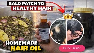 Thumbnail: 20+ Ingredients herbal hair growth oil | Hair Oil for sale | Fresh & Organic with 100% best results 