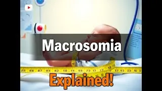 Thumbnail: Macrosomia