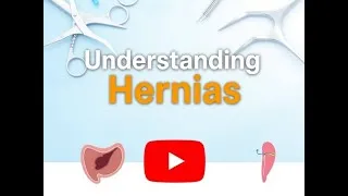 Thumbnail: Understanding Hernia