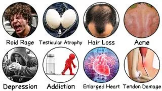 Thumbnail: Dangerous Effects of Abusing Steroids Explained