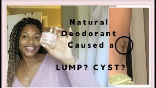 Thumbnail: Nontoxic Deodorant Caused a Lump #Cruelty-Free #EcoFriendlyProducts #Nontoxic #NaturalProducts