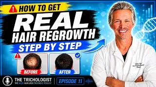 Thumbnail: Have Hair Loss? Stop it and REGROW IT: The Ultimate Step-by-Step Guide