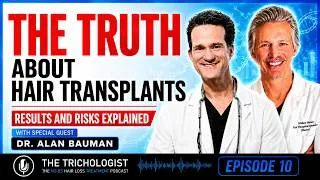 Thumbnail: Don't Get a Hair Transplant Until You Watch This - Dr. Alan Bauman on FUE, FUT, Turkey Hairlines