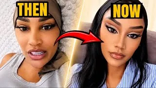 Thumbnail: ZARI HASSAN NEW FACE (aka Zarithebosslady) MY FACE IS MY PERSONAL BRAND ZARI DEFEND PLASTIC SURGERY 