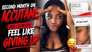 Thumbnail: The Truth About Accutane Month 2 | Nobody Prepared Me For This