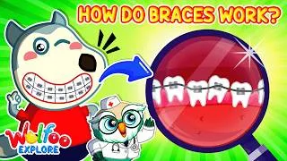 Thumbnail: How Do Braces Work? 😬🦷 | 🔍Wolfoo Explore - Human Body | Educational Videos