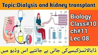 Thumbnail: Dialysis and kidney Transplant|Biology#10thclass |Peritoneal dialysis|Haemodialysis.