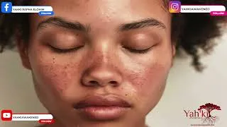 Thumbnail: She Said It Was Lupus, but what about her THYROID? 