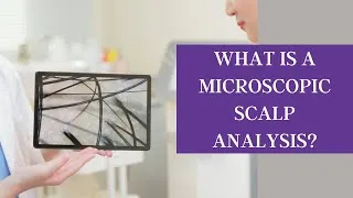 Thumbnail: What is a Microscopic Scalp Analysis?
