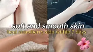 Thumbnail: Ultimate Guide to Smooth and Soft skin In 7 days | Get rid of strawberry skin fast |