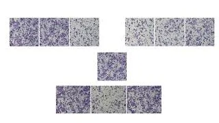 Thumbnail: duplication