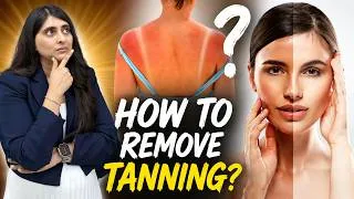 Thumbnail: How To Remove Tanning? Home Remedies for Tanning| How to remove Tan from Face and body?
