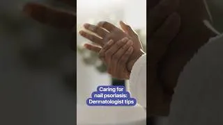 Thumbnail: Manage nail psoriasis with these dermatologist tips