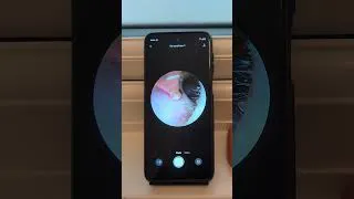 Thumbnail: Bebird EarSight Ultra X: Able to See Everything!