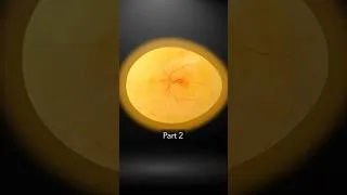 Thumbnail: First Heartbeat part 2