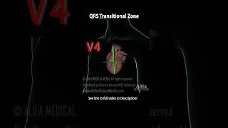 Thumbnail: QRS Transitional Zone and R-Wave Progression #medicalanimation #ekg #ecg #3danimation #cardiology