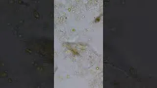 Thumbnail: A Hidden World: Flagellates Swimming Through Algae 🔬